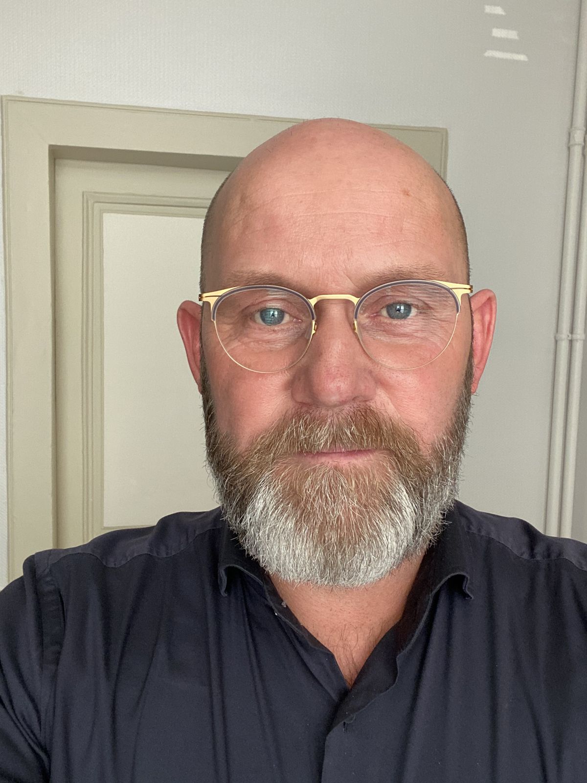 files/bald.jpg